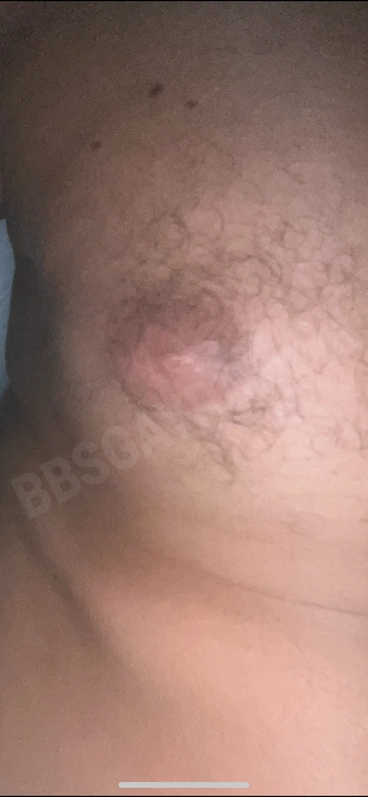 AlexaAA4453578