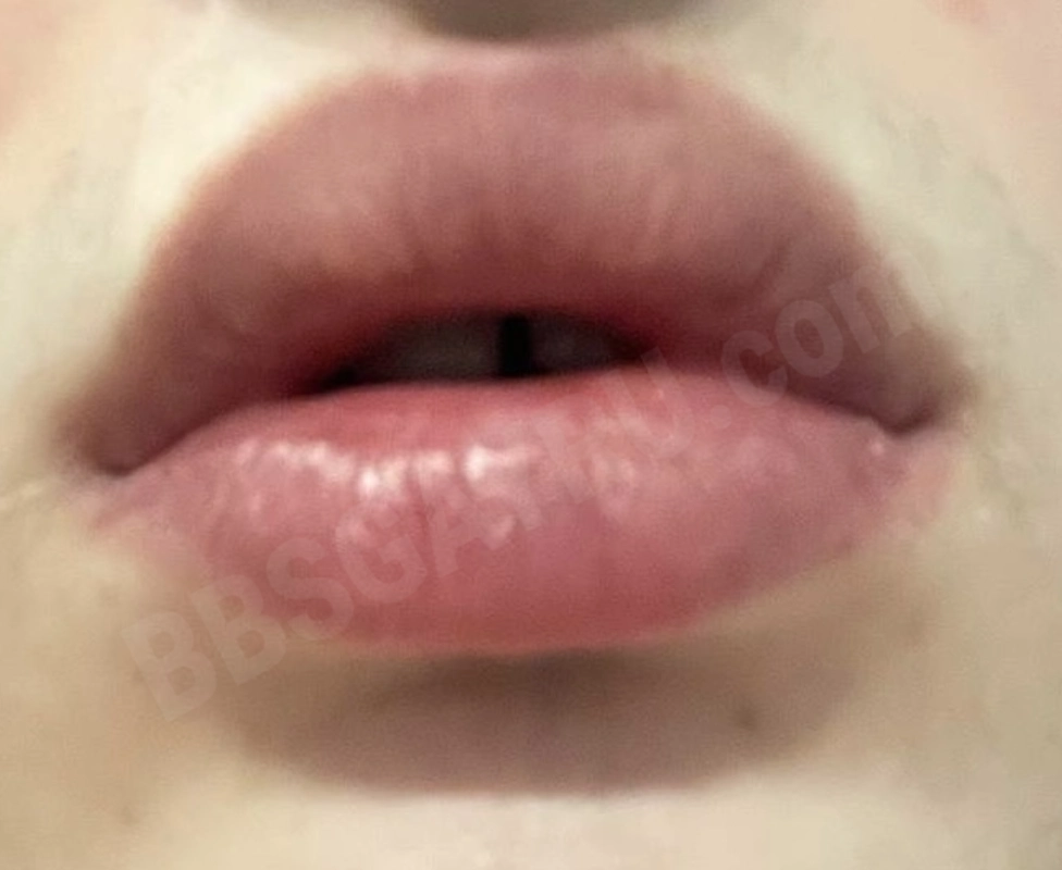 Aiilu4498419