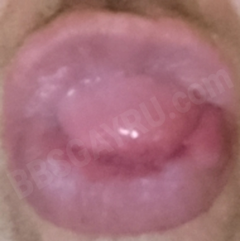 Riiimmm77774649712