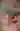 AL9551573