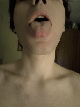 Skrelis